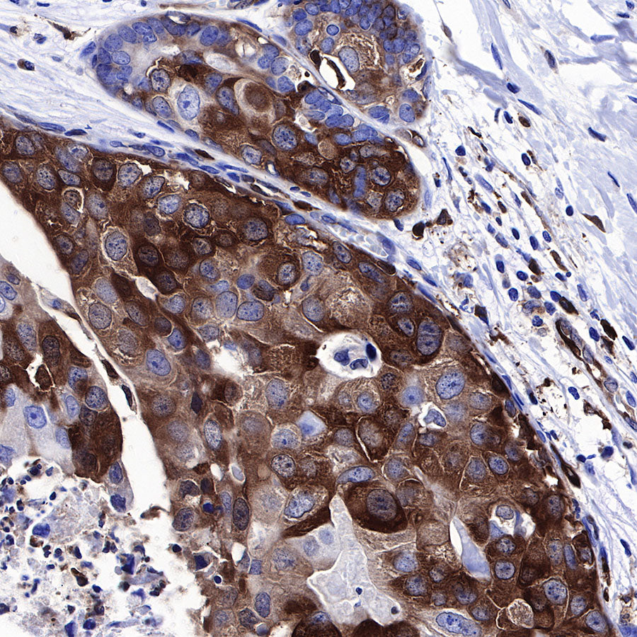 Stathmin 1 Recombinant Rabbit mAb (SDT-383-4)