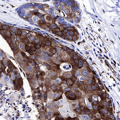 Stathmin 1 Recombinant Rabbit mAb (SDT-383-4)