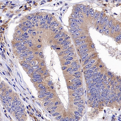 p38α MAPK+p38β MAPK Recombinant Rabbit mAb (S-1300-102)