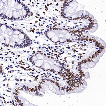 Lamin A/C Recombinant Rabbit mAb (S-950-164)
