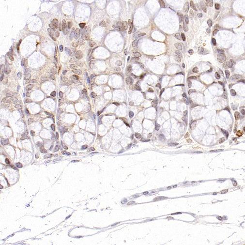 Histone H3 (acetyl K4) Recombinant Rabbit mAb (S-848-137)