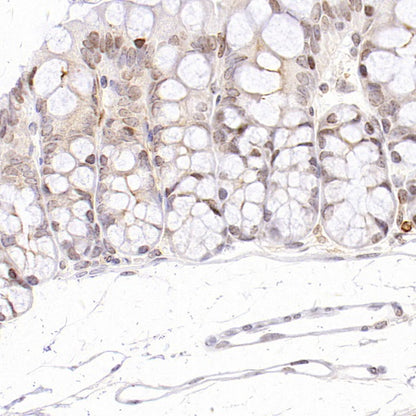 Histone H3 (acetyl K4) Recombinant Rabbit mAb (S-848-137)