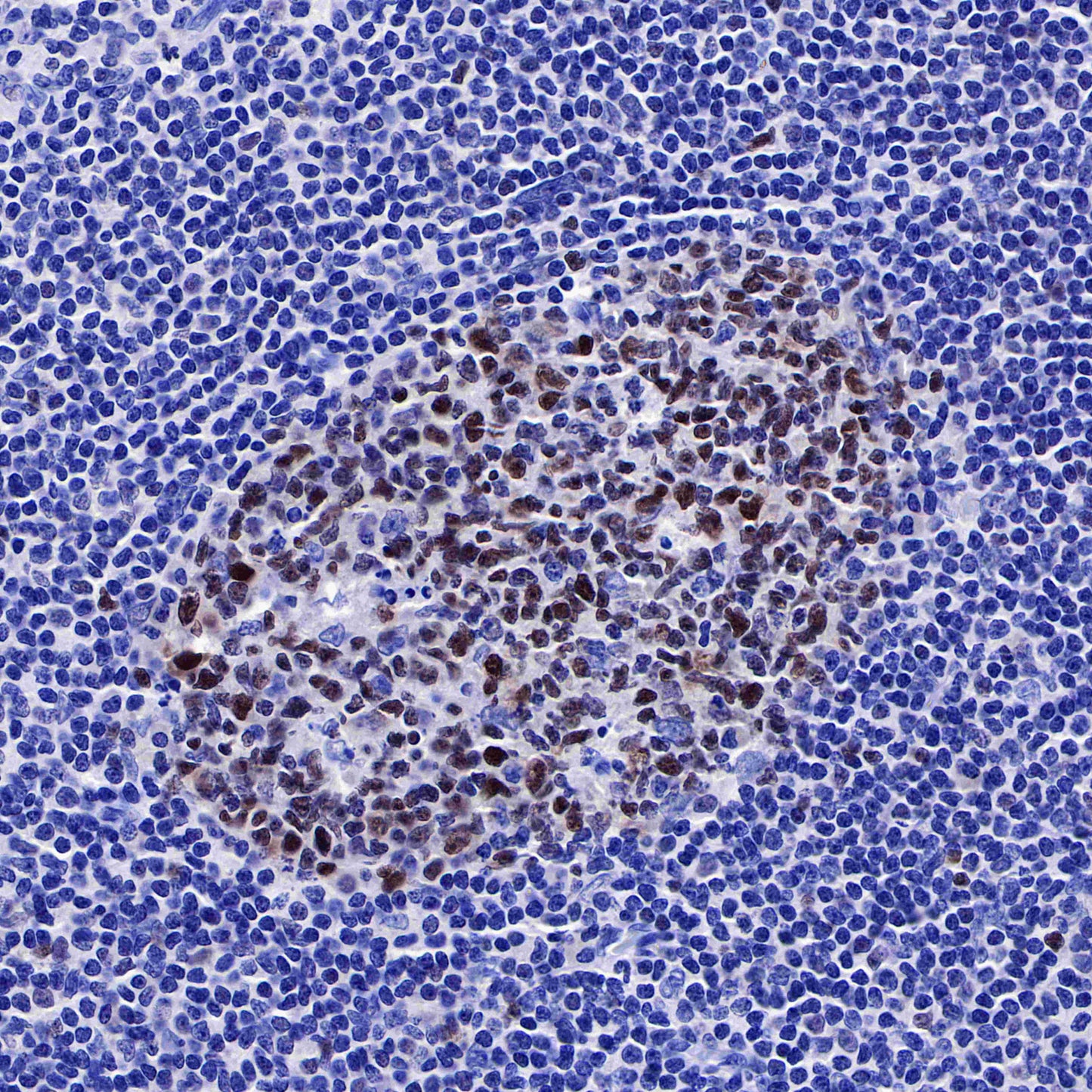 S-RMab® BCL-6 Recombinant Rabbit mAb,PBS Only (SDT-103-21)