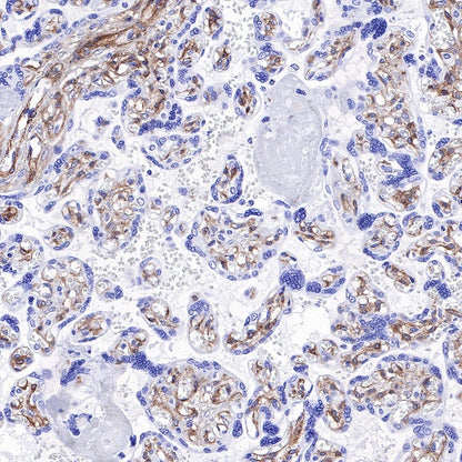 PDGFRA+PDGFRB Recombinant Rabbit mAb (S-393-11)