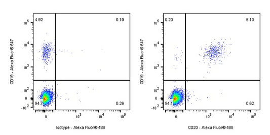 Mouse Anti-Human CD20 Antibody (2H7)