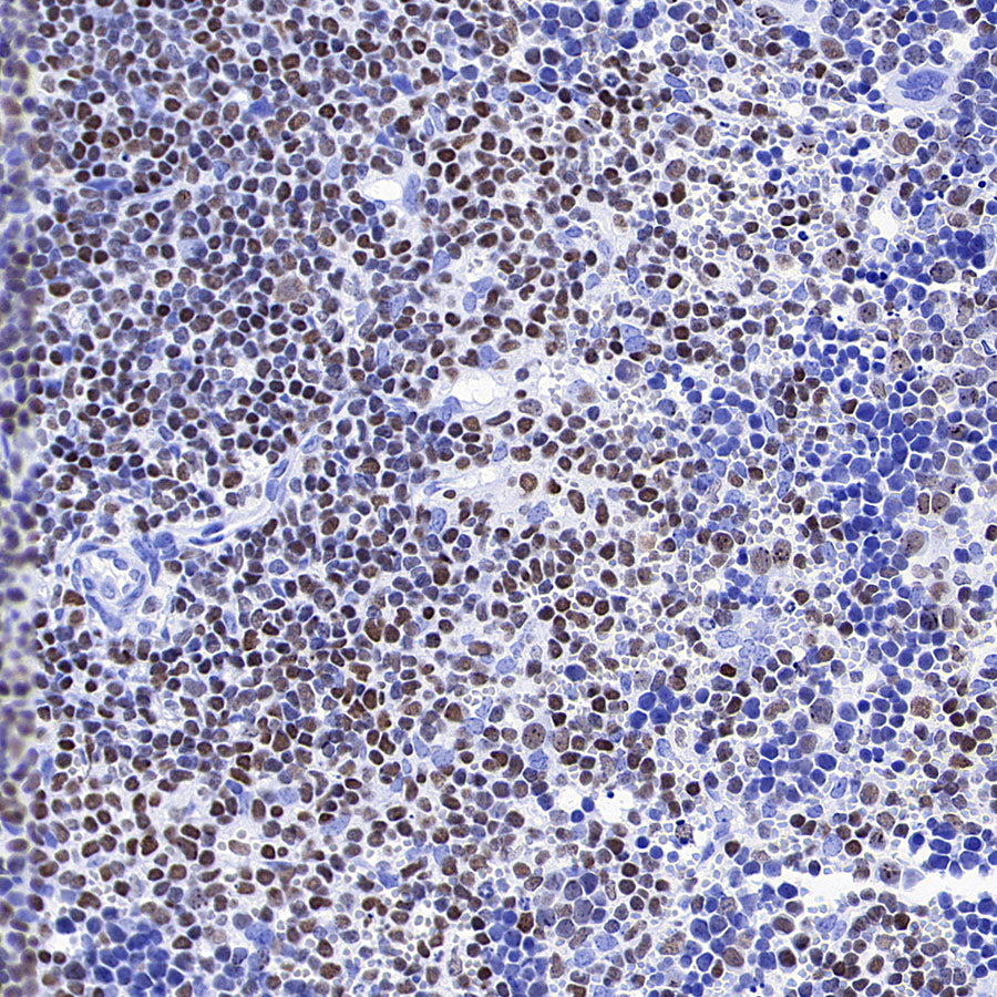 IKZF1 Recombinant Rabbit mAb (S-4176-17)