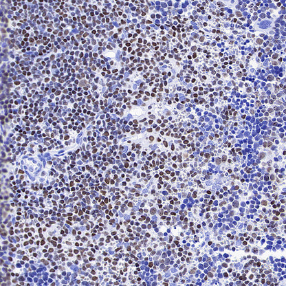 IKZF1 Recombinant Rabbit mAb (S-4176-17)