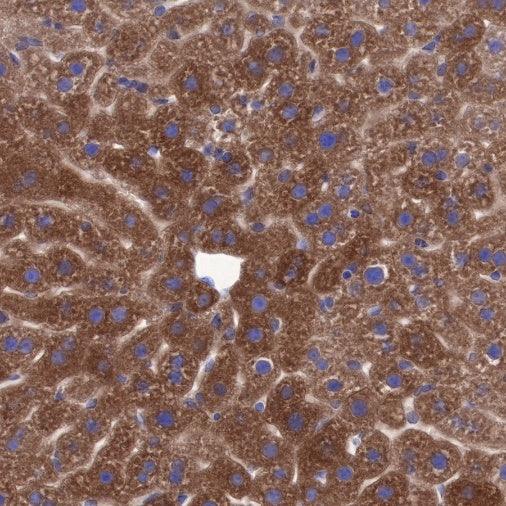 CTEN Recombinant Rabbit mAb (SDT-R175)