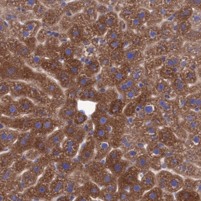 CTEN Recombinant Rabbit mAb (SDT-R175)