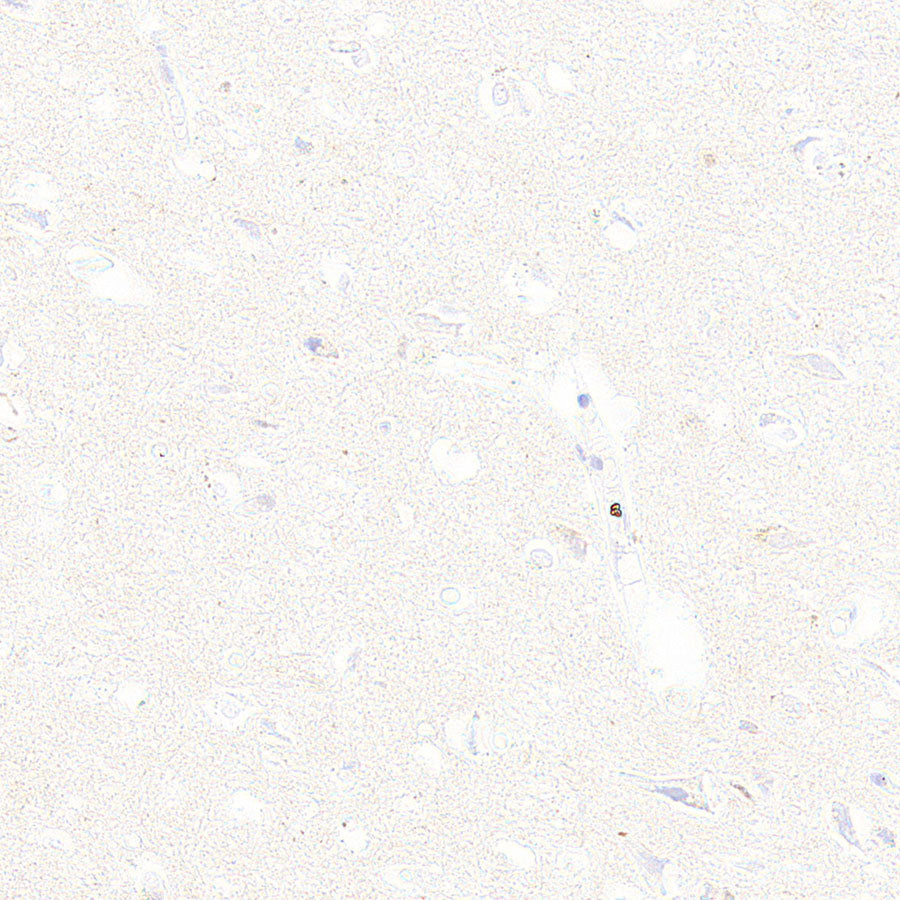 Galectin-9 Recombinant Rabbit mAb (S-4579-67)