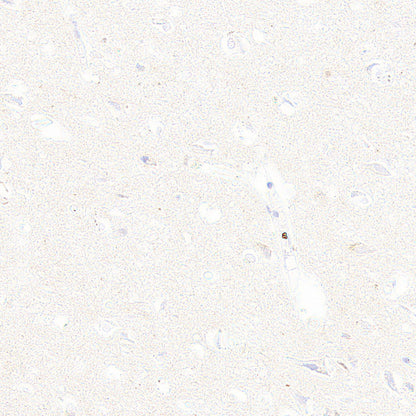 Galectin-9 Recombinant Rabbit mAb (S-4579-67)