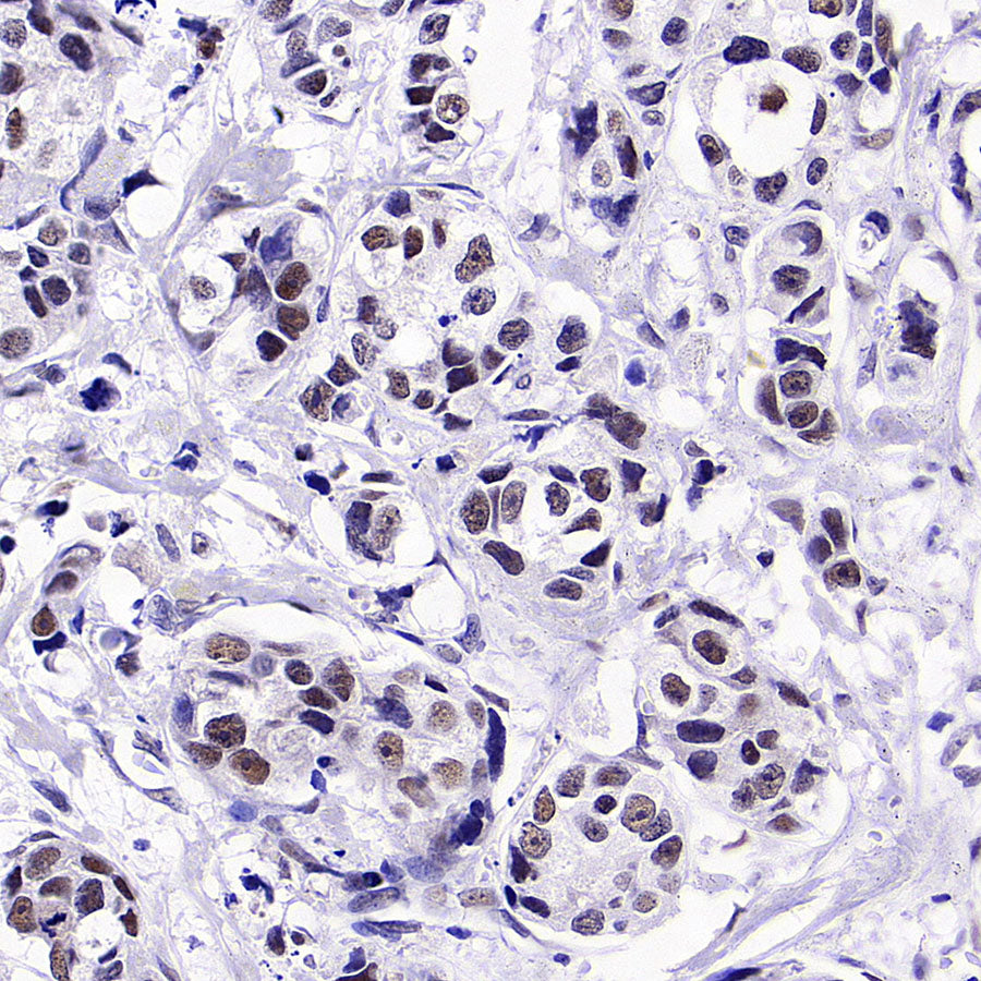 BRCA2 Recombinant Rabbit mAb (S-5306)