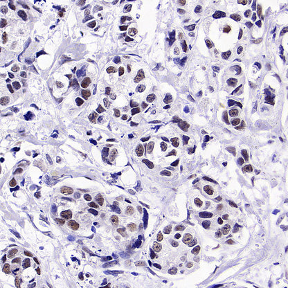 BRCA2 Recombinant Rabbit mAb (S-5306)