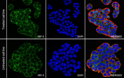IRF3 Recombinant Rabbit mAb (S-3650-63)