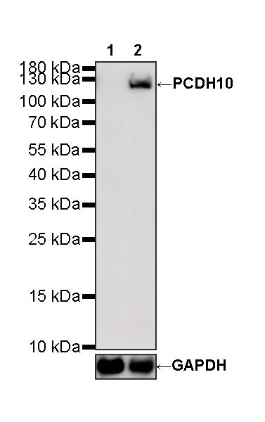 PCDH10 Recombinant Rabbit mAb (S-4531-4)