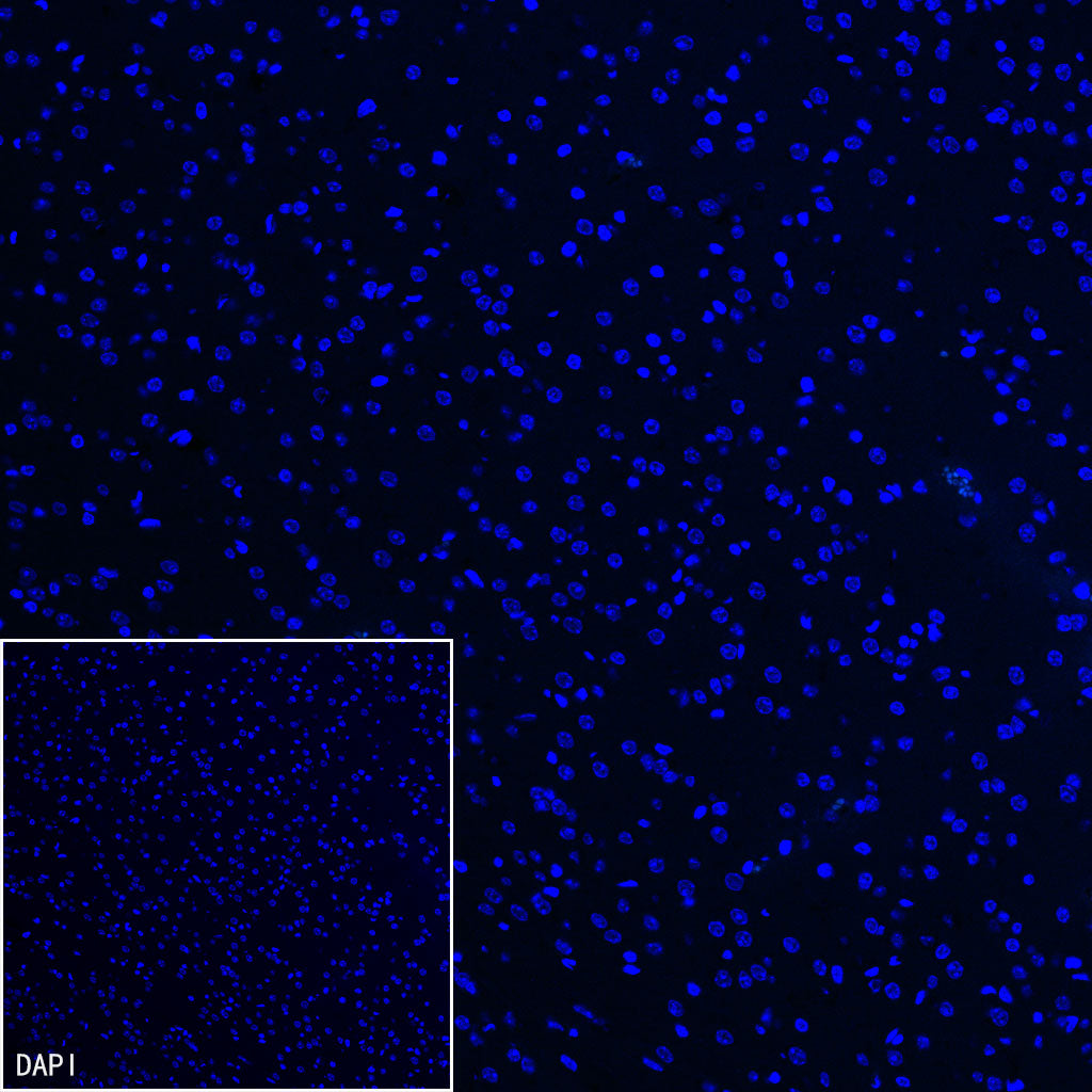 Neutrophil Elastase Recombinant Rabbit mAb (S-4397-22)