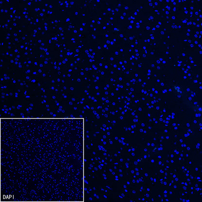Neutrophil Elastase Recombinant Rabbit mAb (S-4397-22)