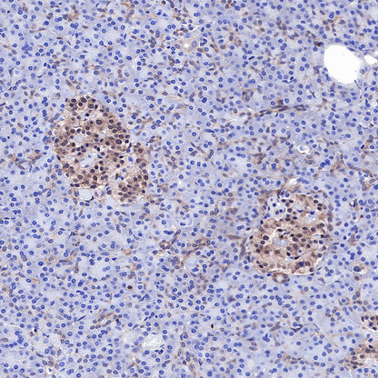 PTEN Recombinant Rabbit mAb (SDT-R074)