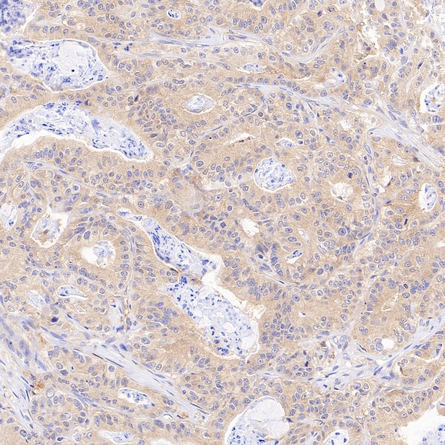 ATG7 Recombinant Rabbit mAb (S-1279-201)