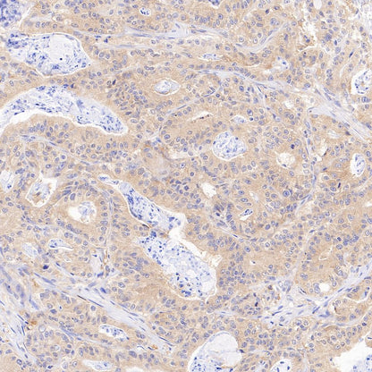 ATG7 Recombinant Rabbit mAb (S-1279-201)