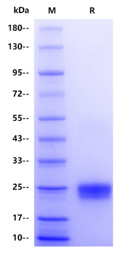 TNF-β His Tag Protein, Human
