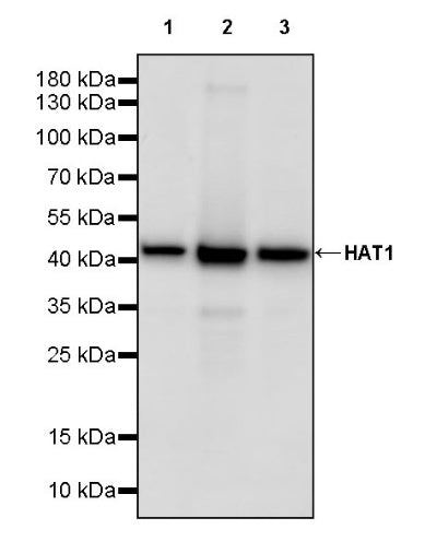 HAT1 Recombinant Rabbit mAb (S-2429-14)