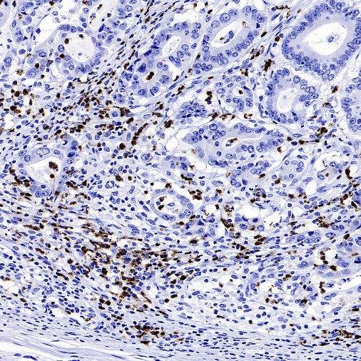 Lipocalin-2/NGAL Recombinant Rabbit mAb (S-2279-72)