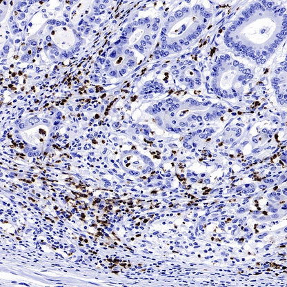 Lipocalin-2/NGAL Recombinant Rabbit mAb (S-2279-72)