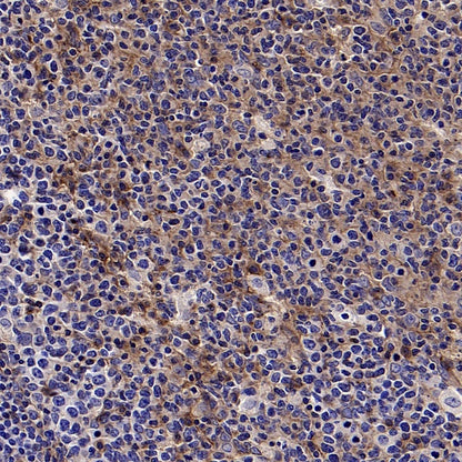 CD59 Mouse mAb (S-936-1)
