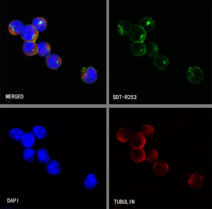 HLA-DRB1 Recombinant Rabbit mAb (SDT-R253)