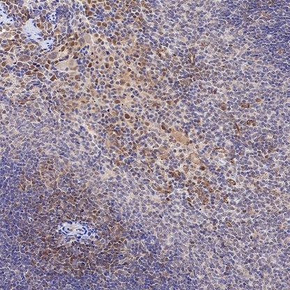 Stat5 Recombinant Rabbit mAb (S-2823-24)