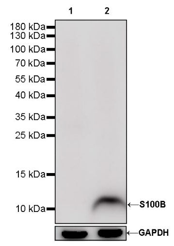 S-RMab® S100B Recombinant Rabbit mAb (SDT-518-45)