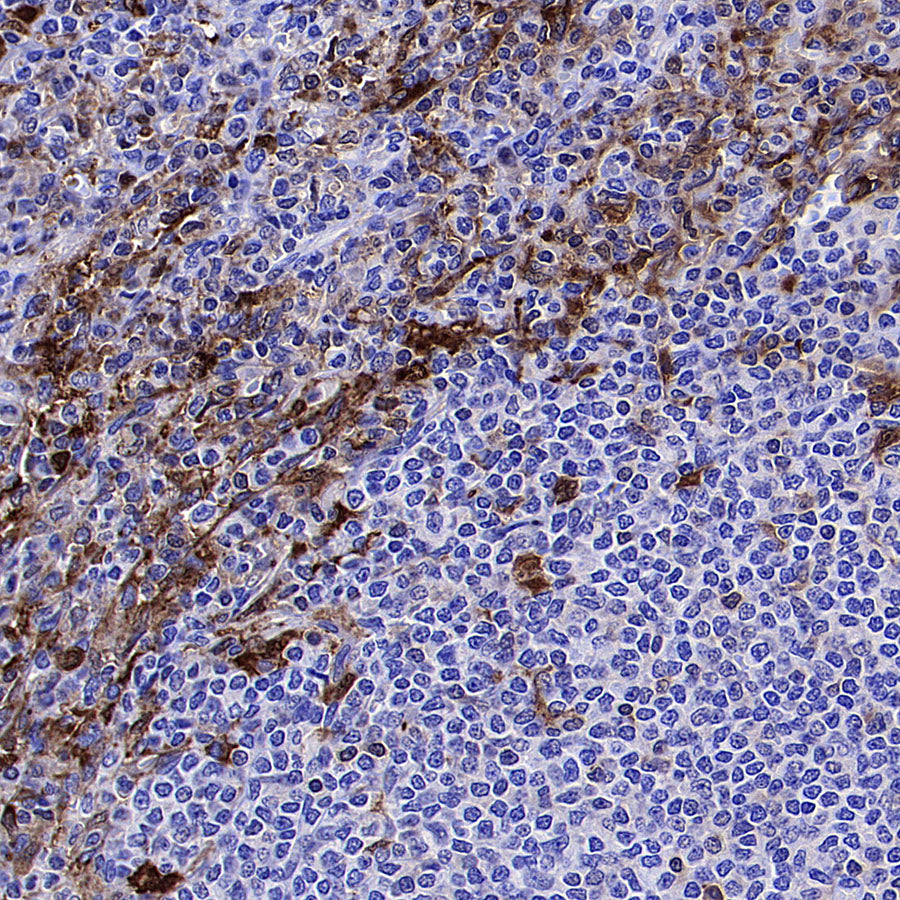 ADA Recombinant Rabbit mAb (S-5470)