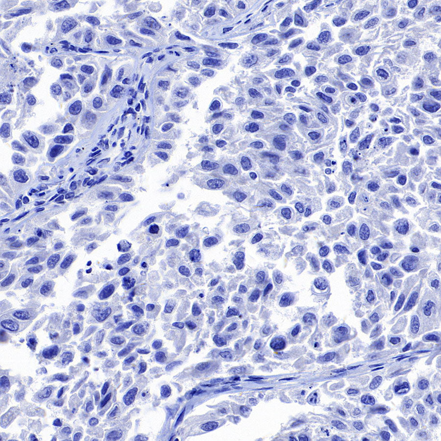 Hepatocyte Specific Antigen Recombinant Mouse mAb (SDT-4389)