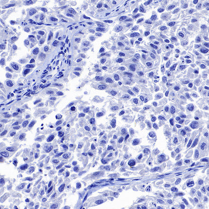 Hepatocyte Specific Antigen Recombinant Mouse mAb (SDT-4389)