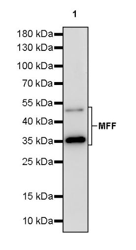 MFF Recombinant Rabbit mAb (S-2330-28)