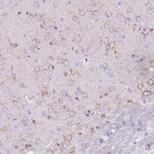 SORT1 Recombinant Rabbit mAb (S-2233-47)