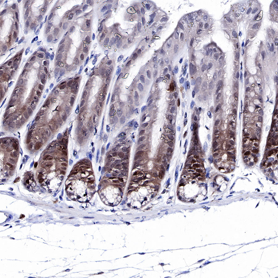 CDK2 Recombinant Rabbit mAb (SDT-064-40)