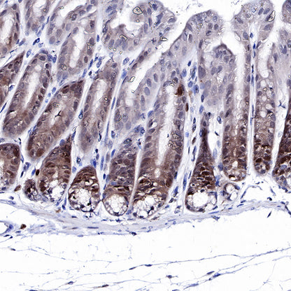 CDK2 Recombinant Rabbit mAb (SDT-064-40)