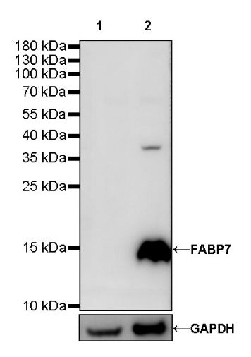 FABP7 Recombinant Rabbit mAb (S-762-41)