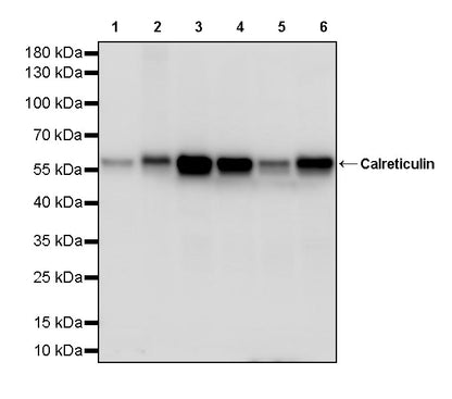 Calreticulin Recombinant Rabbit mAb (S-3920-39)