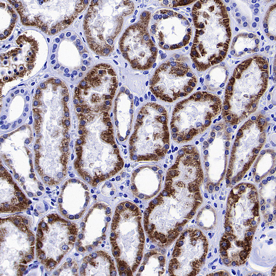Monoamine Oxidase B/MAOB Recombinant Rabbit mAb (S-5317)