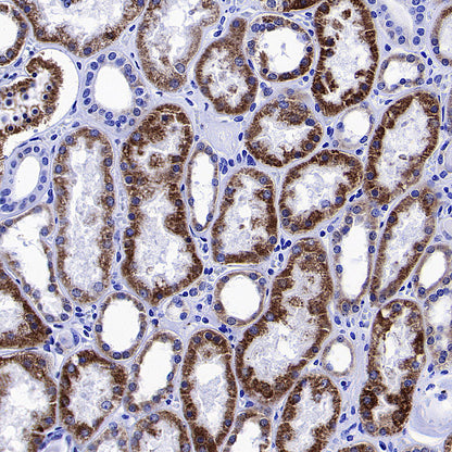 Monoamine Oxidase B/MAOB Recombinant Rabbit mAb (S-5317)