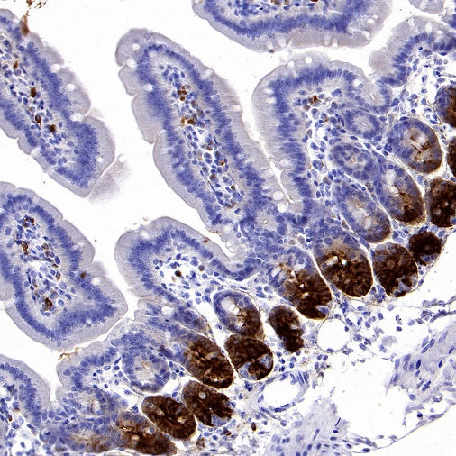 Olfm4 Recombinant Rabbit mAb (S-2748-67)