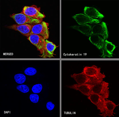 Cytokeratin 19 Recombinant Rabbit  mAb,PBS Only (SDT-107-19)