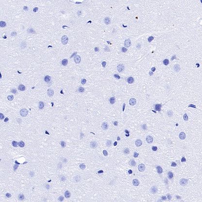 S-RMab® FSHB Recombinant Rabbit mAb (SDT-544-22)