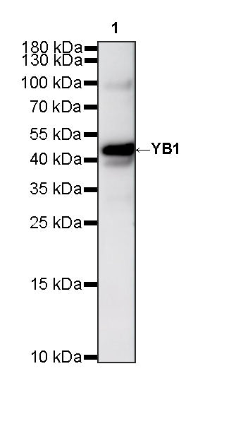 YB1 Recombinant Rabbit mAb (S-6245)