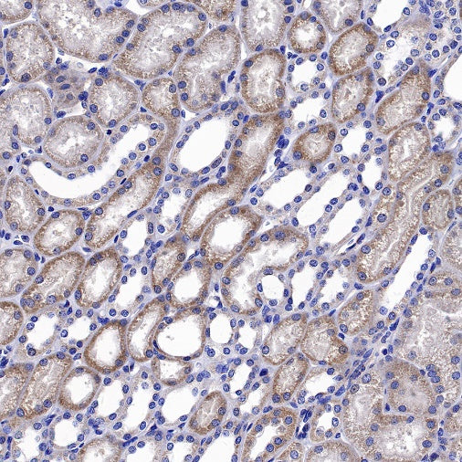 Neuropilin 1 Recombinant Rabbit mAb (S-1453-6)