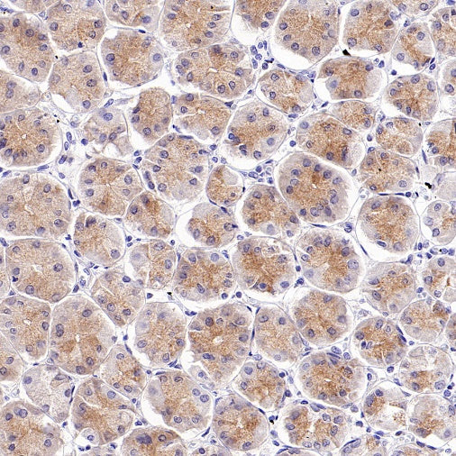 INPP4B Recombinant Rabbit mAb (S-3210-62)