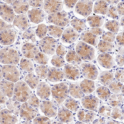 INPP4B Recombinant Rabbit mAb (S-3210-62)